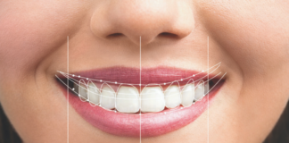 Sonrisas que cuentan historias: La nueva era de la salud estética